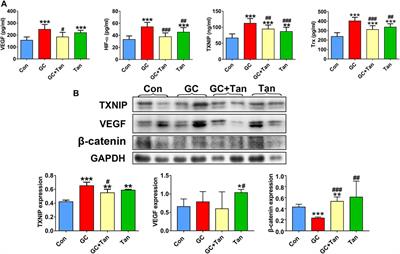 Tanshinol Alleviates Microcirculation Disturbance and Impaired Bone Formation by Attenuating TXNIP Signaling in GIO Rats